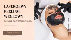 Laserowy peeling węglowy Black Doll Tiffany's Secret Warszawa Praga Południe