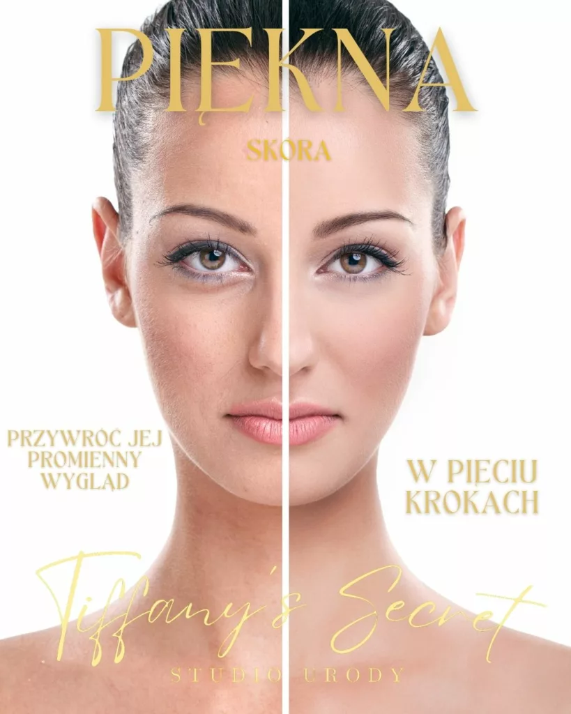 piekna skó®a w pięciu krokach
